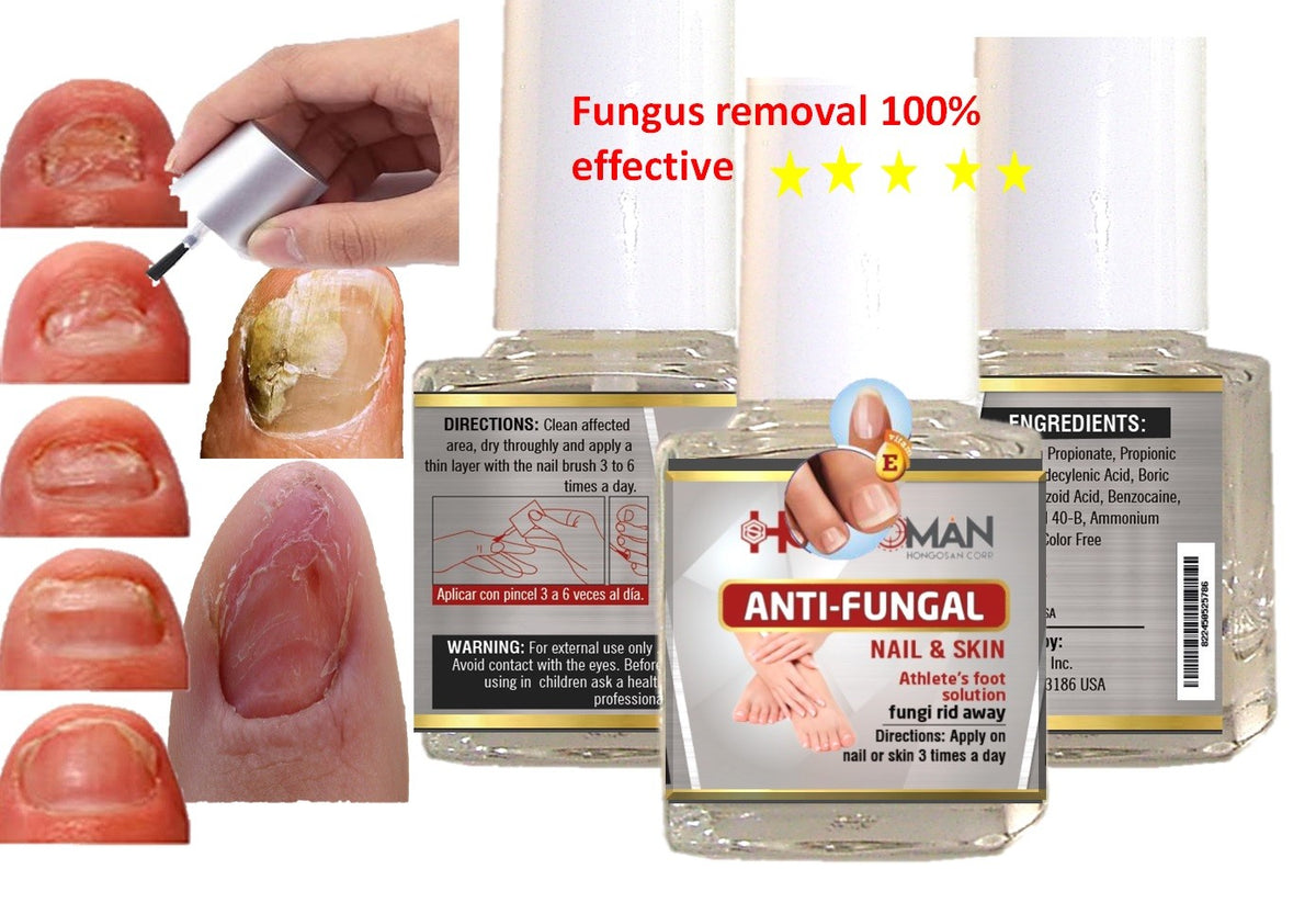 Natural Anti-Fungal Nail Support Kit for Toenails and Feet - 2oz Spray & Brush
