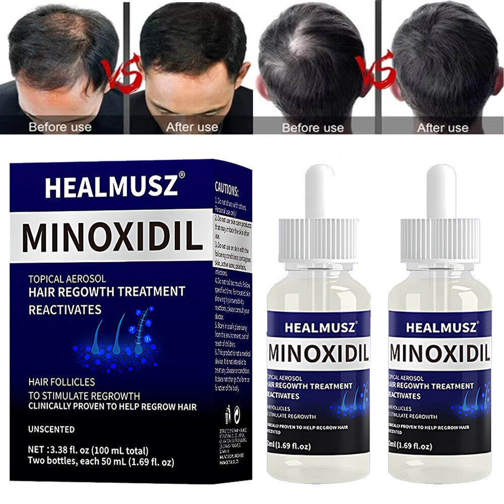 5% Minoxidil Hair Regrowth Treatment - 50ml x 2