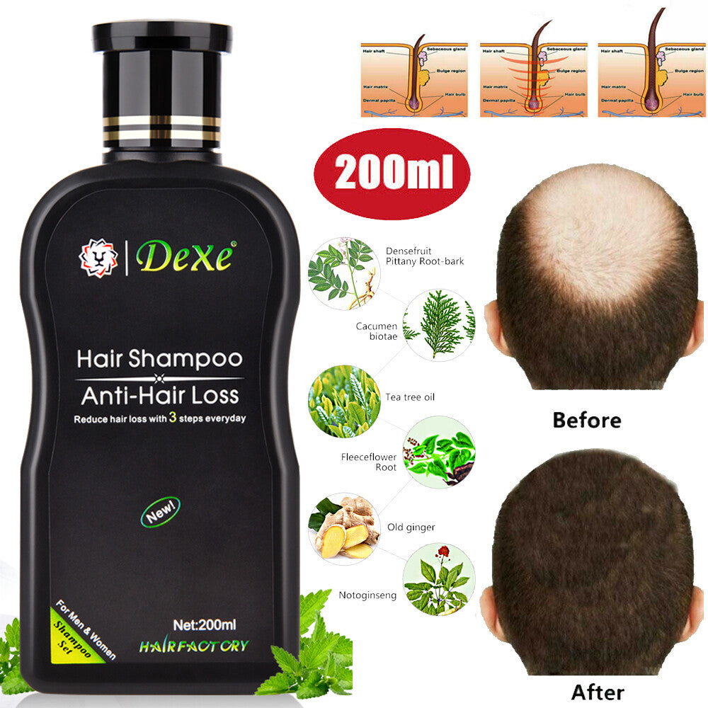 Anti-Hair Loss Shampoo for Men and Women | Dexe Herbal Hair Growth Formula 200ml