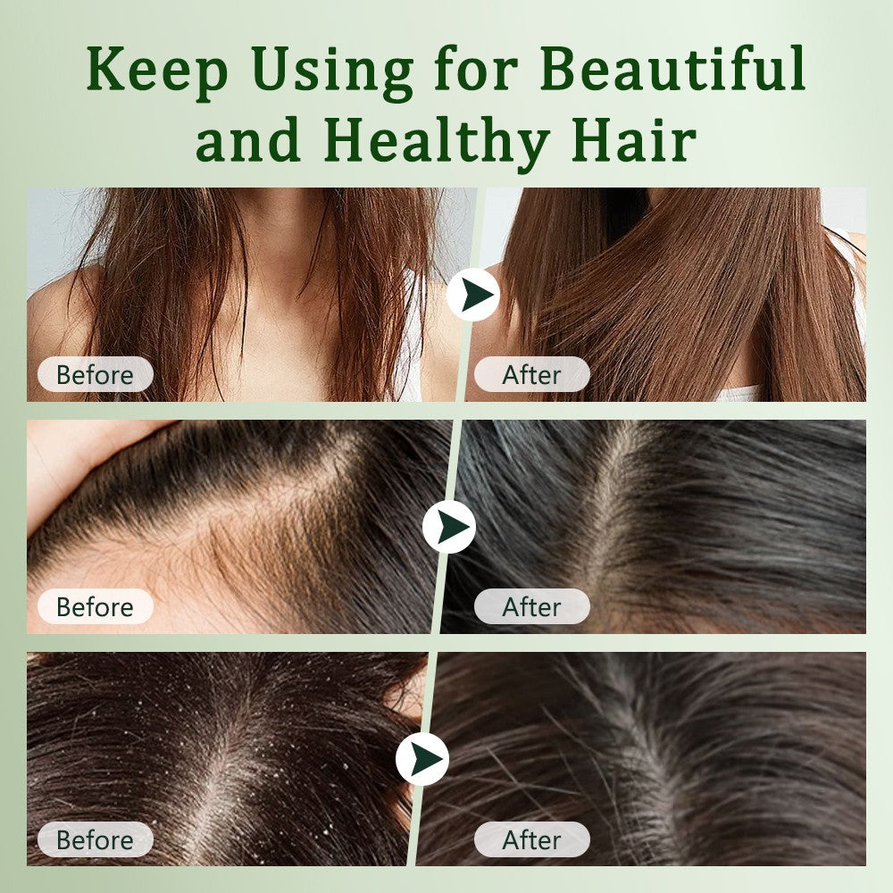 Hair Growth Shampoo Bar with Usman Grass for Thinning Hair & Oily Scalp - Natural & Eco-Friendly