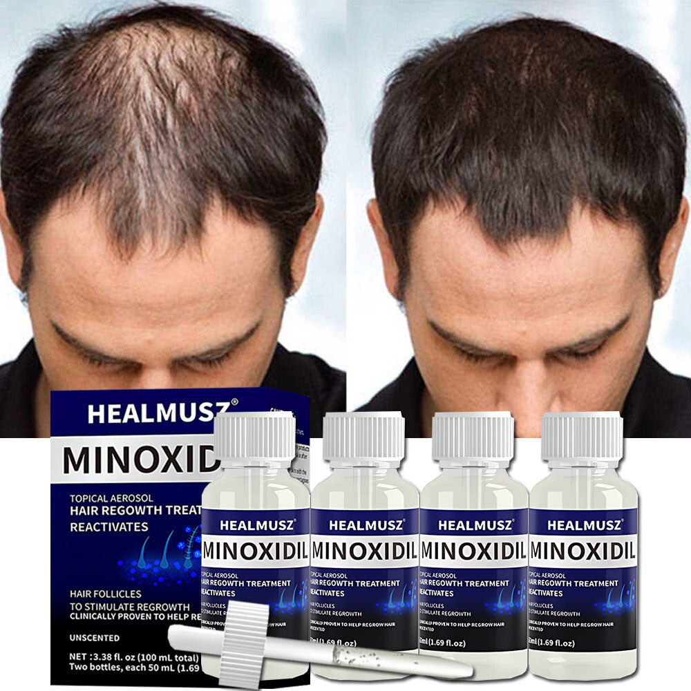 Men's 5% Minoxidil Hair Regrowth Treatment – 4 Month Supply