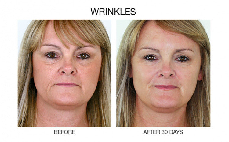 Anti-Aging Face Serum with Plant Stem Cells Hyaluronic Acid Matrixyl 3000