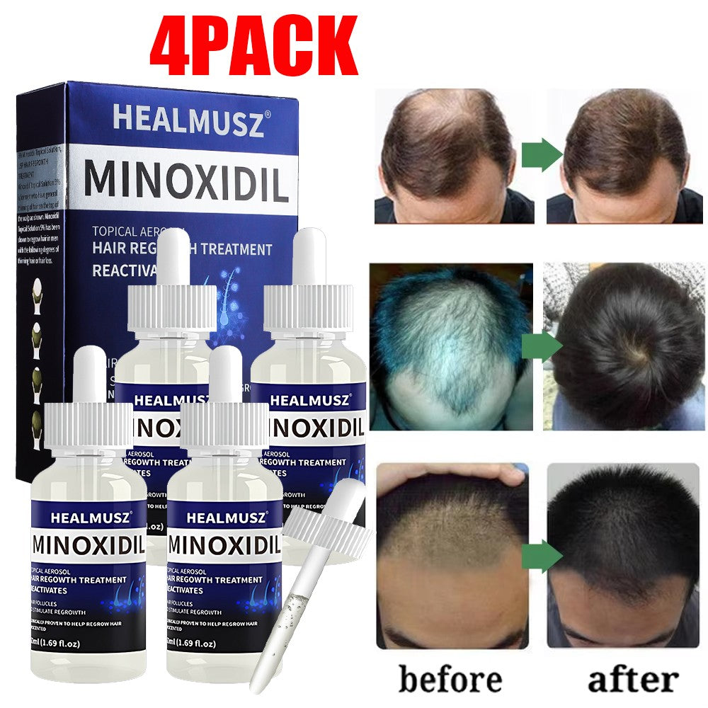 Minoxidil 5% Extra Strength Hair Regrowth Treatment for Men