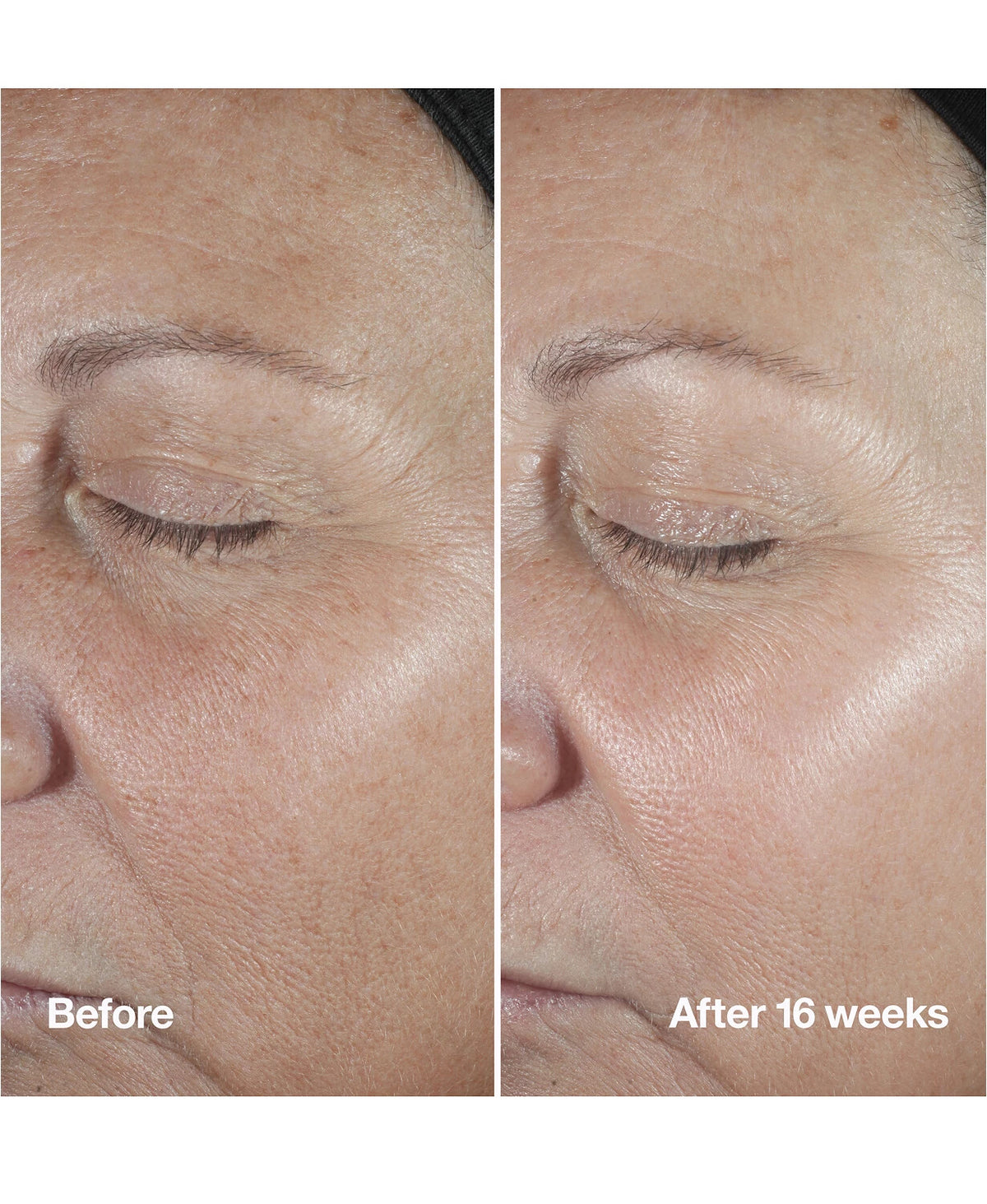 Clinique Smart Clinical Repair Wrinkle Correcting Serum - Anti-Aging Face Treatment