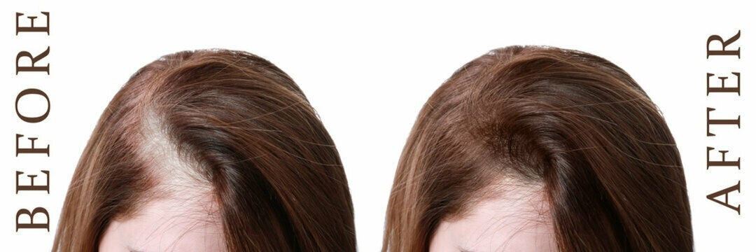 Hair Loss Treatment DHT Blocker Supplement - 60 Capsules