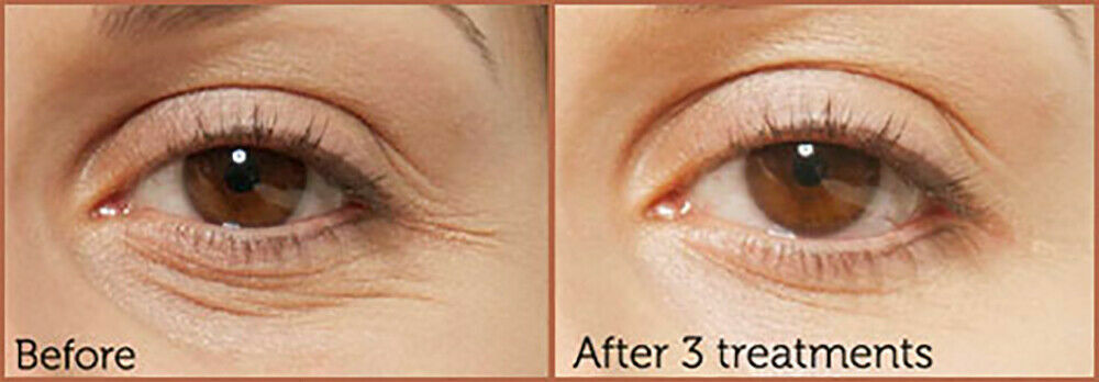 Pure Hyaluronic Acid Serum for Hydrating & Anti-Aging Skin Care - Plumps Fine Lines