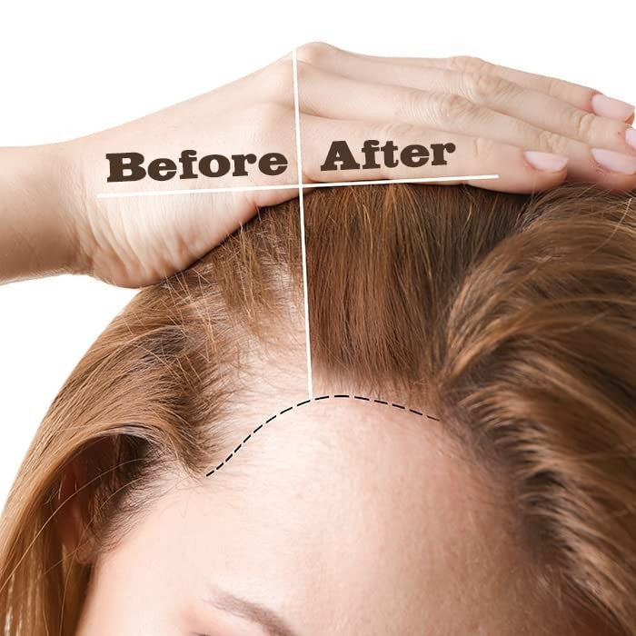 Rosemary Hair Growth Oil with Vitamin E – 60ml