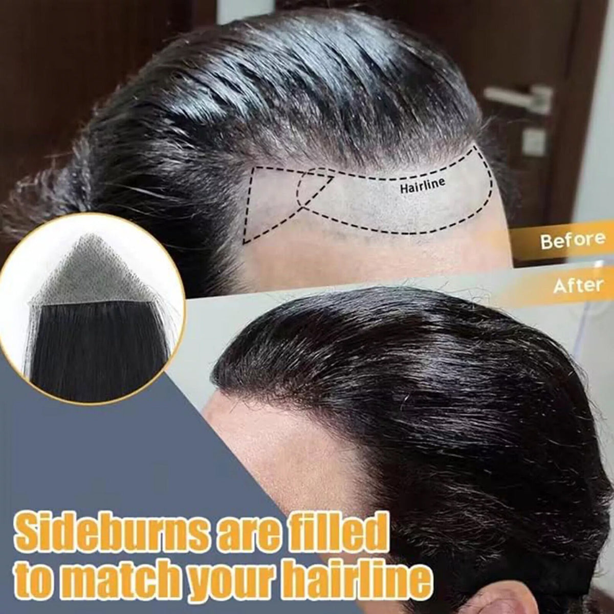 Men's Hair Loss Replacement Patch for Receding Hairline and Bald Spots