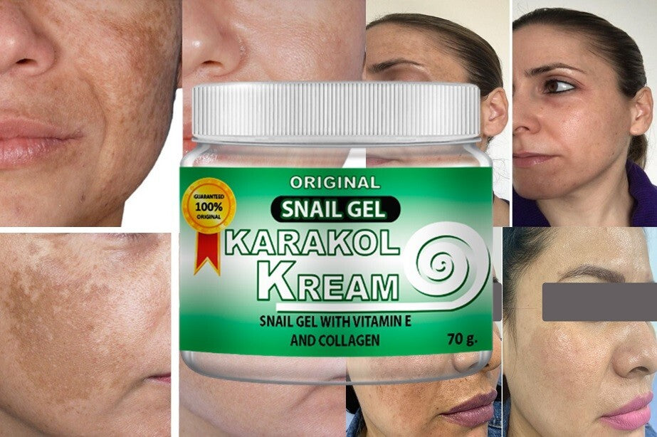 Karakol Acne Gel for Dark Spots & Moisturizing Skin Care - 2oz