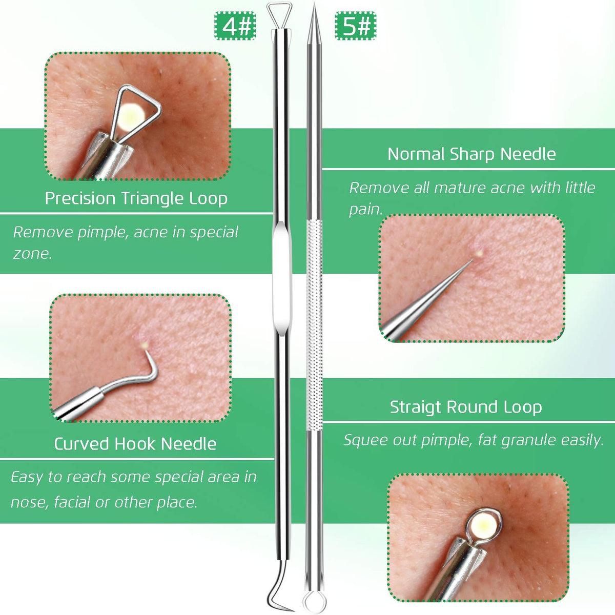 Blackhead Remover Comedone Extractor Set - 5PCS Skin Pore Tool Kit