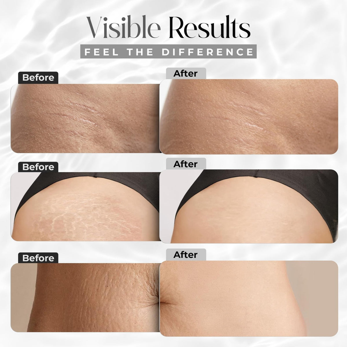 Stretch Marks Cream with Collagen Support and Hydrating Formula - 1 fl oz