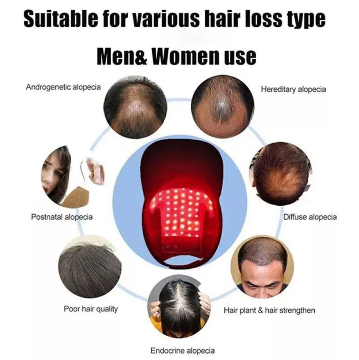 LED Hair Growth Cap – Red Light Therapy Hat 630nm