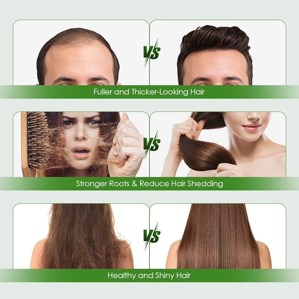 Hair Growth Serum with Micro Needle Roller - 1.5 fl oz