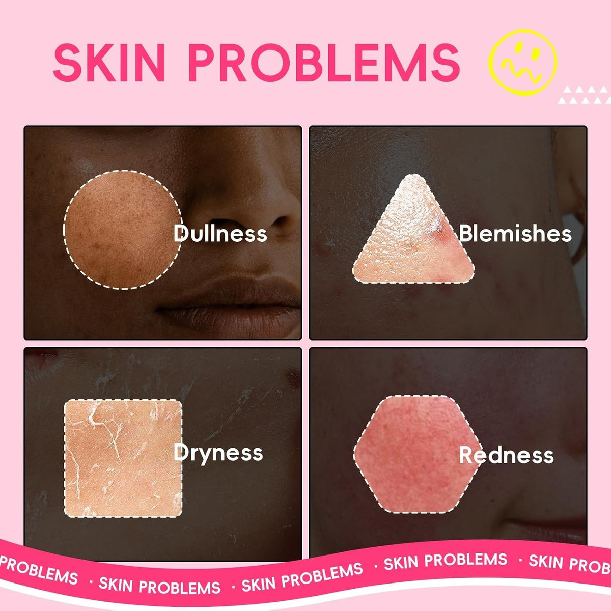 Watermelon & Niacinamide Skincare Set for Radiant, Glowing Skin - 5-Piece Kit