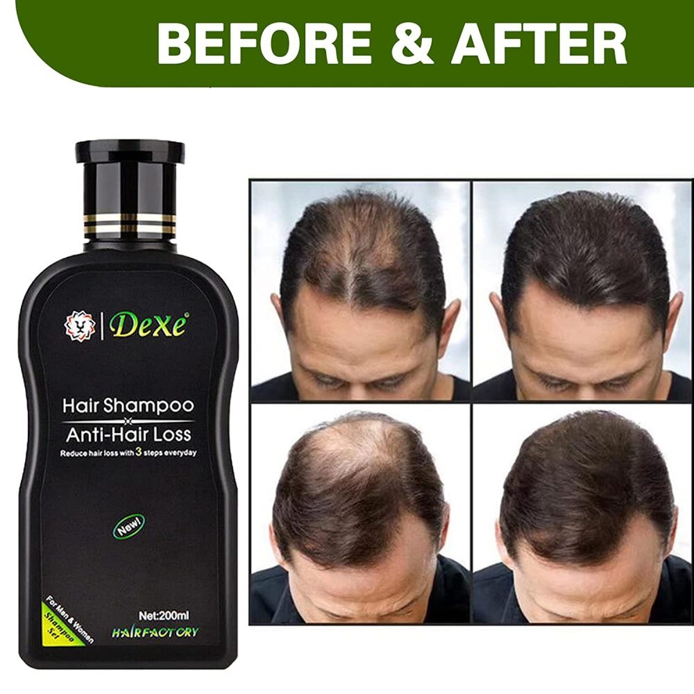 Hair Growth Shampoo Set - Anti-Hair Loss, 5 x 200ml