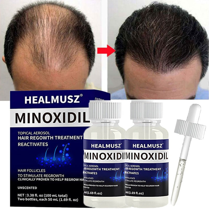 Minoxidil 5% Hair Regrowth Treatment for Men - 2 Month Supply