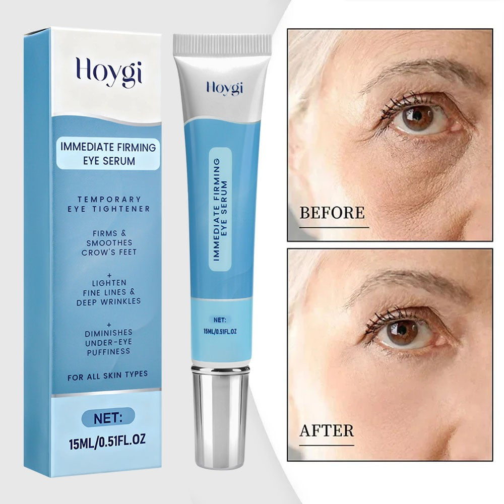 Hydrating Eye Cream for Dark Circles Wrinkles Under Eye Bags 0.5 fl oz