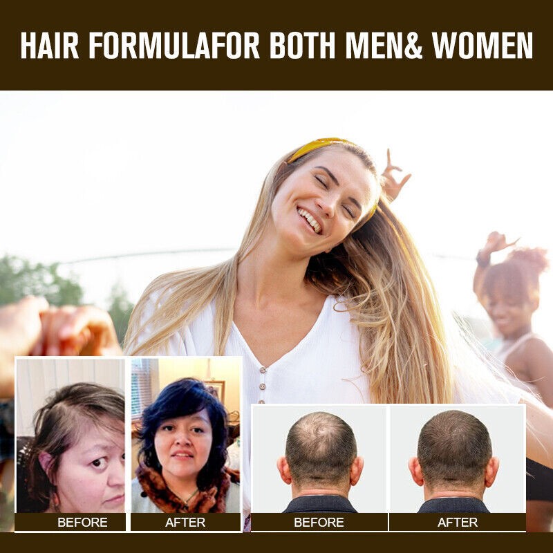 Hair Growth Pills with Collagen & MSM - 60 Capsules