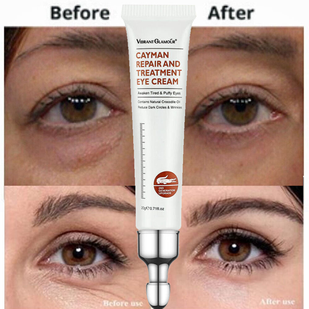 Under Eye Cream for Dark Circles Wrinkles Puffy Eyes - Hydrating & Anti-Aging
