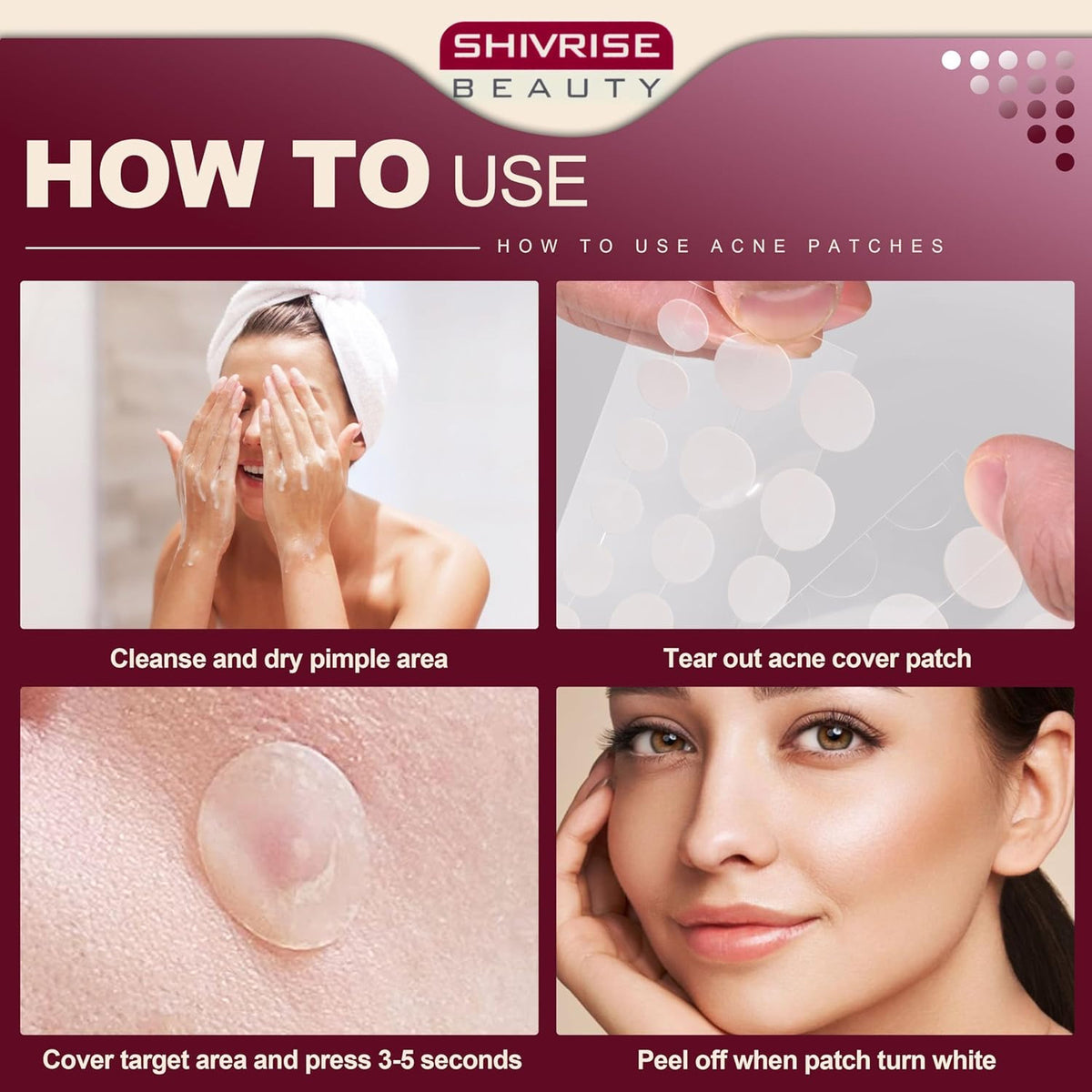 Hydrocolloid Acne Patches for Blemish Covering & Healing - 300 All-Day Skin Discreet