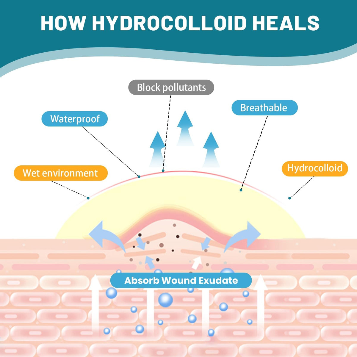 Acne Patch Roll 0.66in x 75in Hydrocolloid