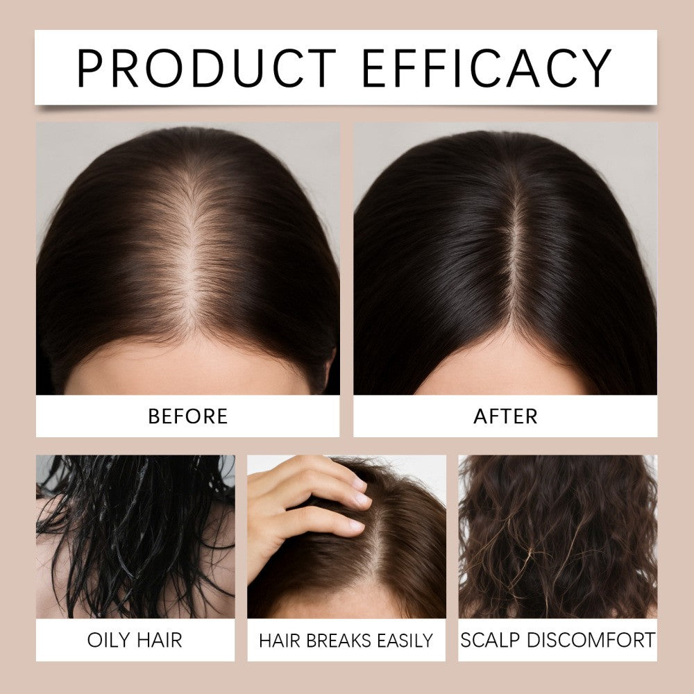 Hair Regrowth Serum with Microneedle Roller – 8-Piece Set