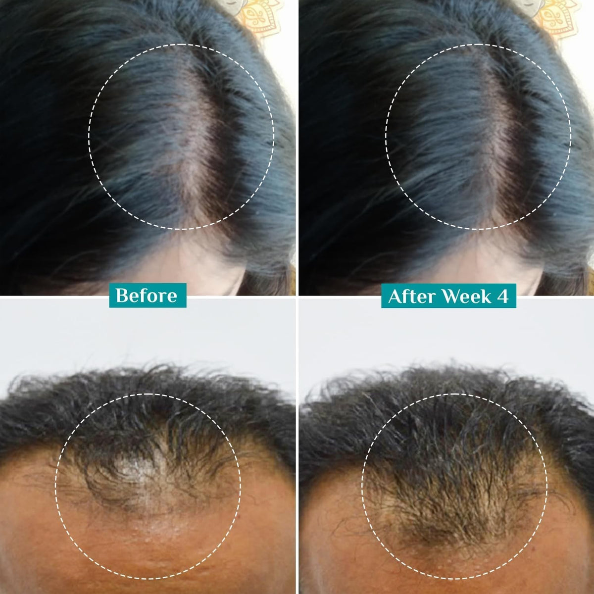Revitalizing Hair Growth Serum with Redensyl - Thicker, Fuller in