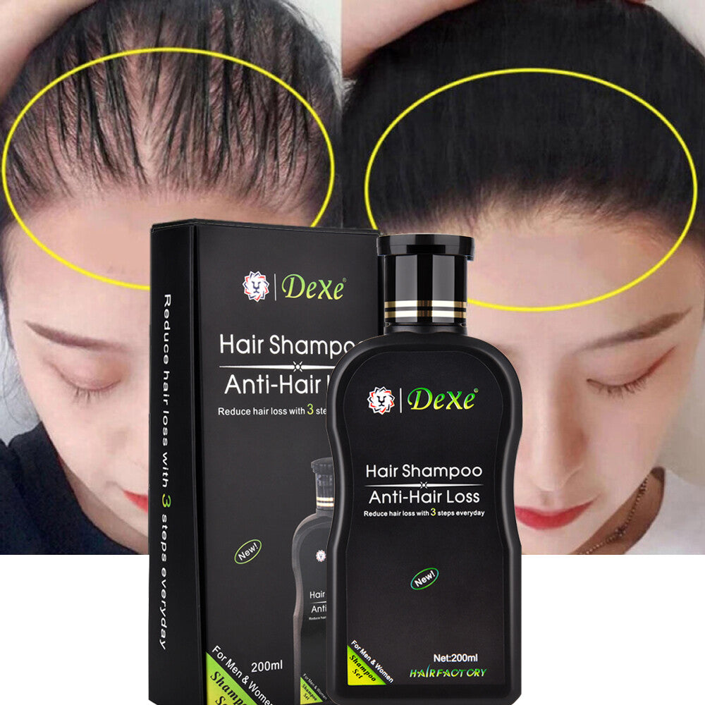 Anti Hair Loss Shampoo - 200ml Herbal Treatment