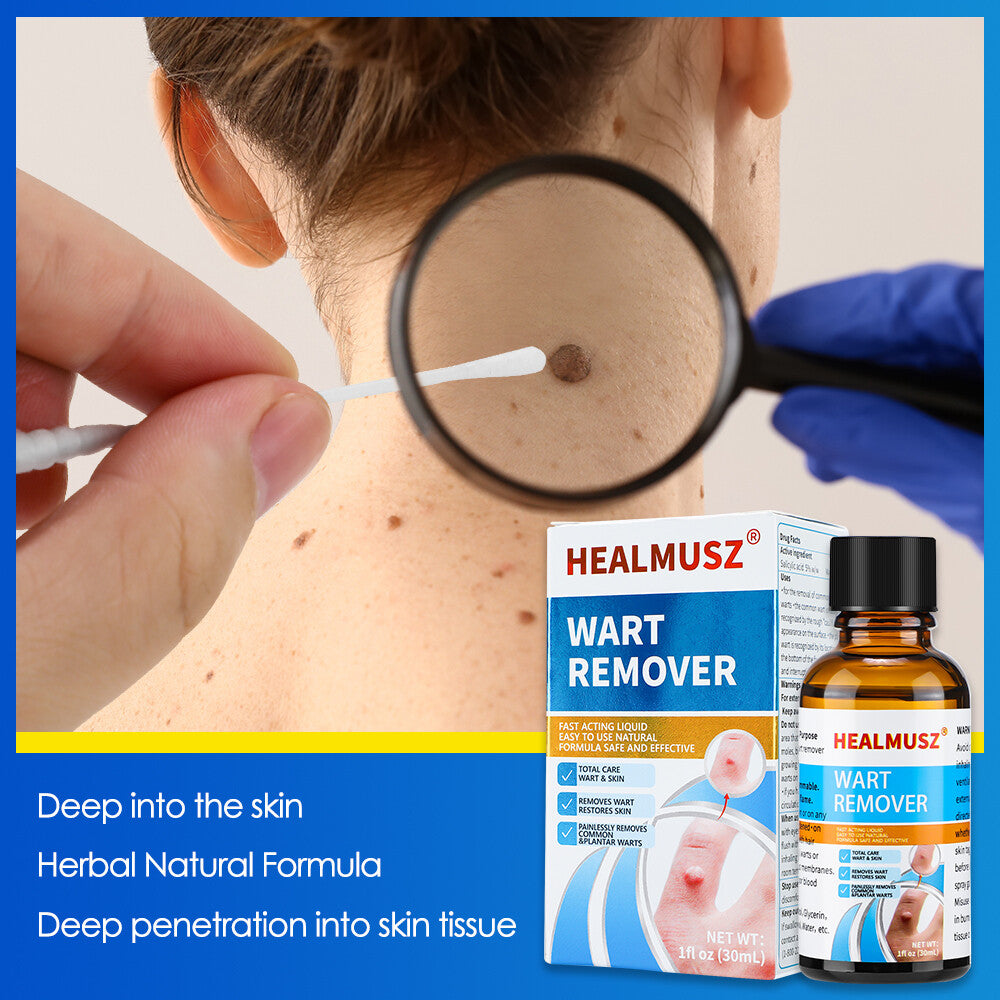 Wart Remover Liquid for Common and Plantar Warts - Natural Herbal Formula