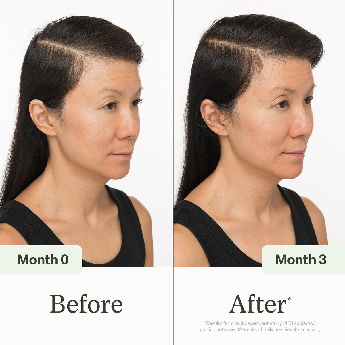 Hair Scalp Serum for Thinning Hair - 3.38 Fl Oz