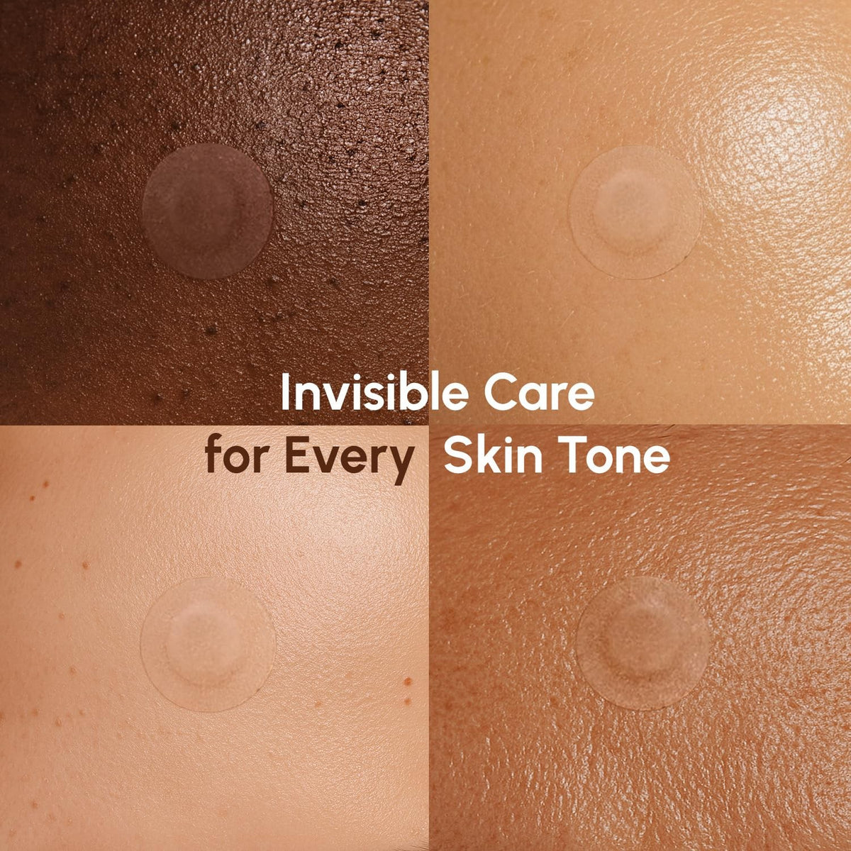 Invisible Acne Pimple Patches - Clear Hydrocolloid 72 Count