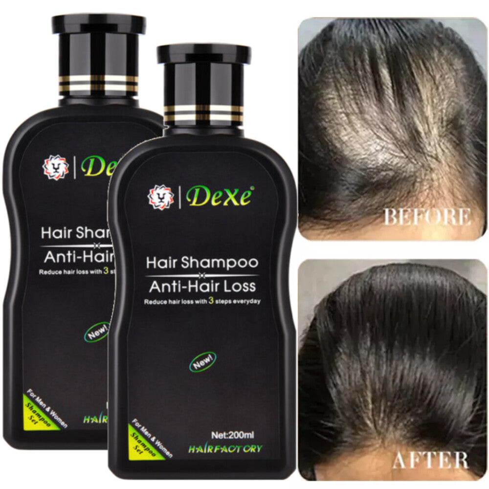 2PCS DEXE Anti-Hair Loss Shampoo Ginger Herbal Hair Regrowth For Men