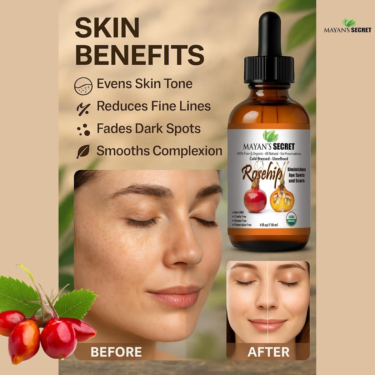 Organic Rosehip Oil 4oz - Pure Cold Pressed Skin & Body Moisturizer
