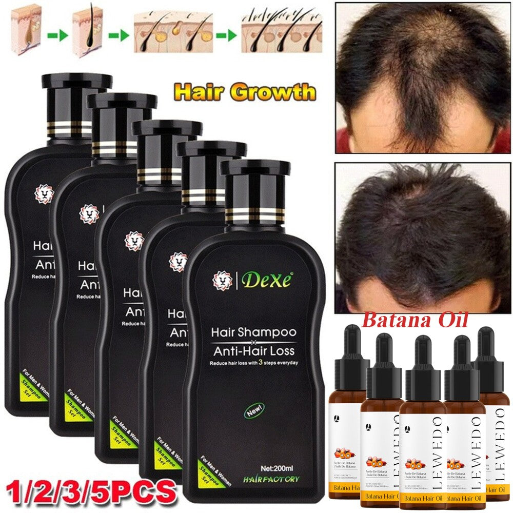 Hair Growth Shampoo Anti-Hair Loss Treatment 200ml