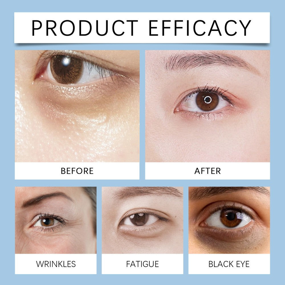 Firming Eye Serum for Dark Circles & Wrinkles - 3 Pack, Hydrating & Lifting