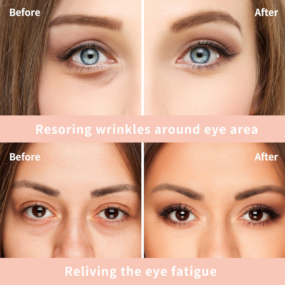 Anti-Aging Eye Cream Gel for Dark Circles & Bags - Brightening & Firming