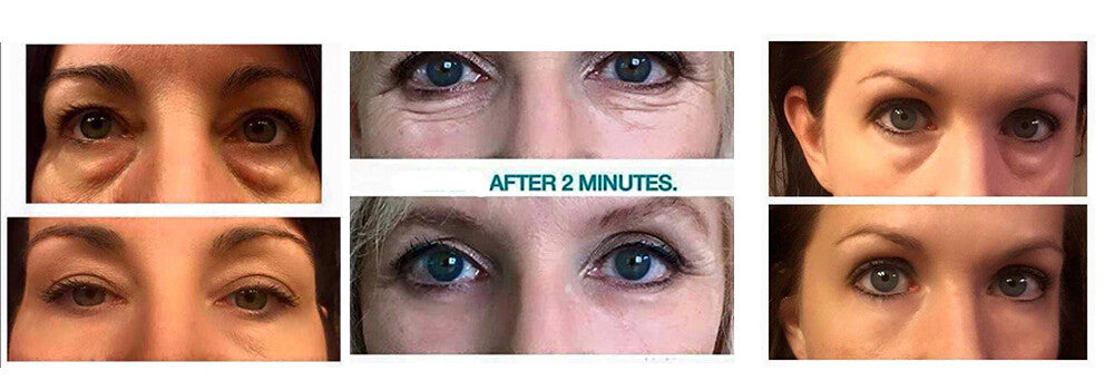 Instantly Ageless Wrinkle Remover Vials - Facelift & Anti-Aging Cream Set