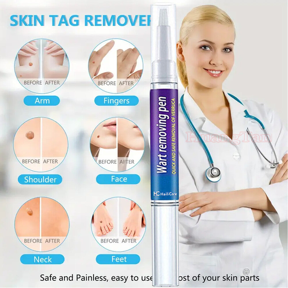 Wart Remover Pen 3-Pack - Fast, Painless Skin Tag and Mole Eliminator
