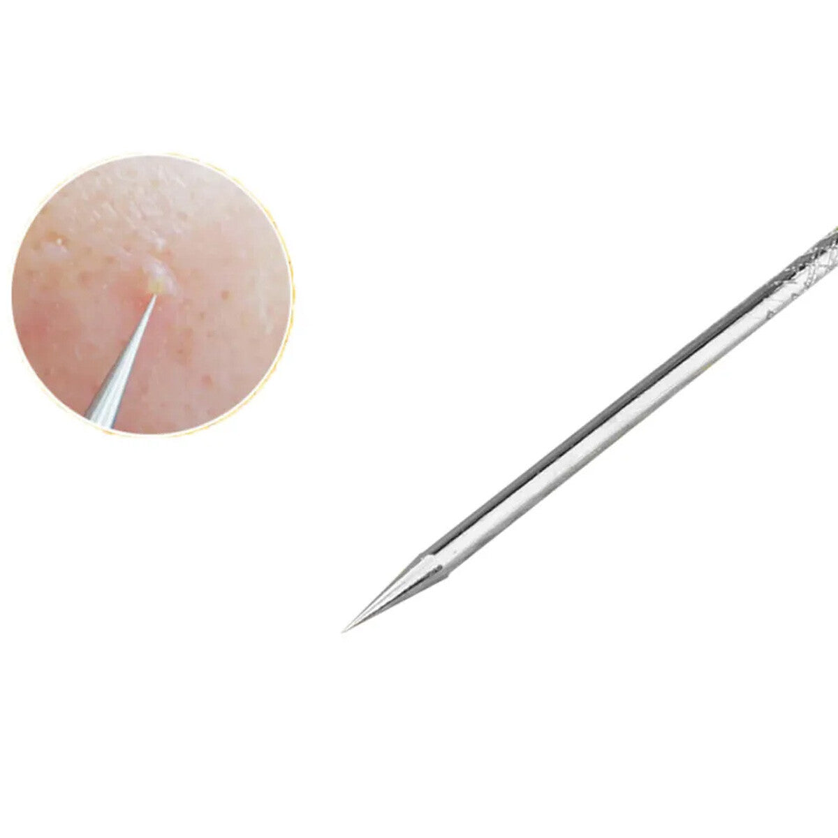 Blackhead & Pimple Remover Kit - 10 Stainless Steel Comedone Extractors
