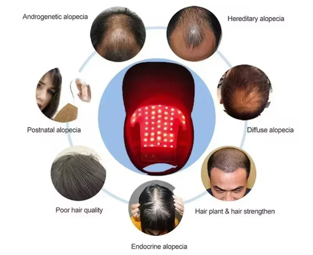Red Light Therapy Cap LED Hair Growth Hat Scalp Treatment