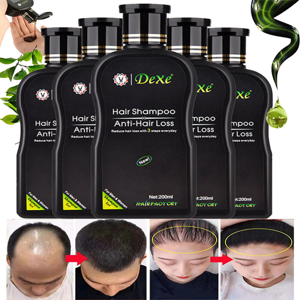 Anti-Hair Loss Shampoo for Men and Women - Nourishing Hair Growth 200ml