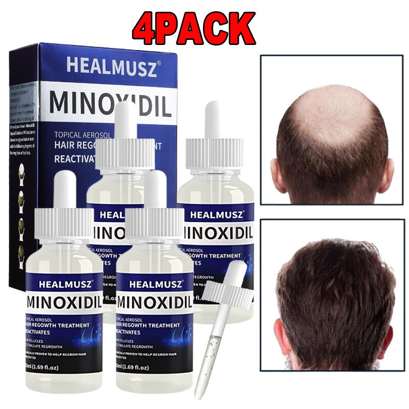 Minoxidil 5% Extra Strength Hair Regrowth Treatment for Men