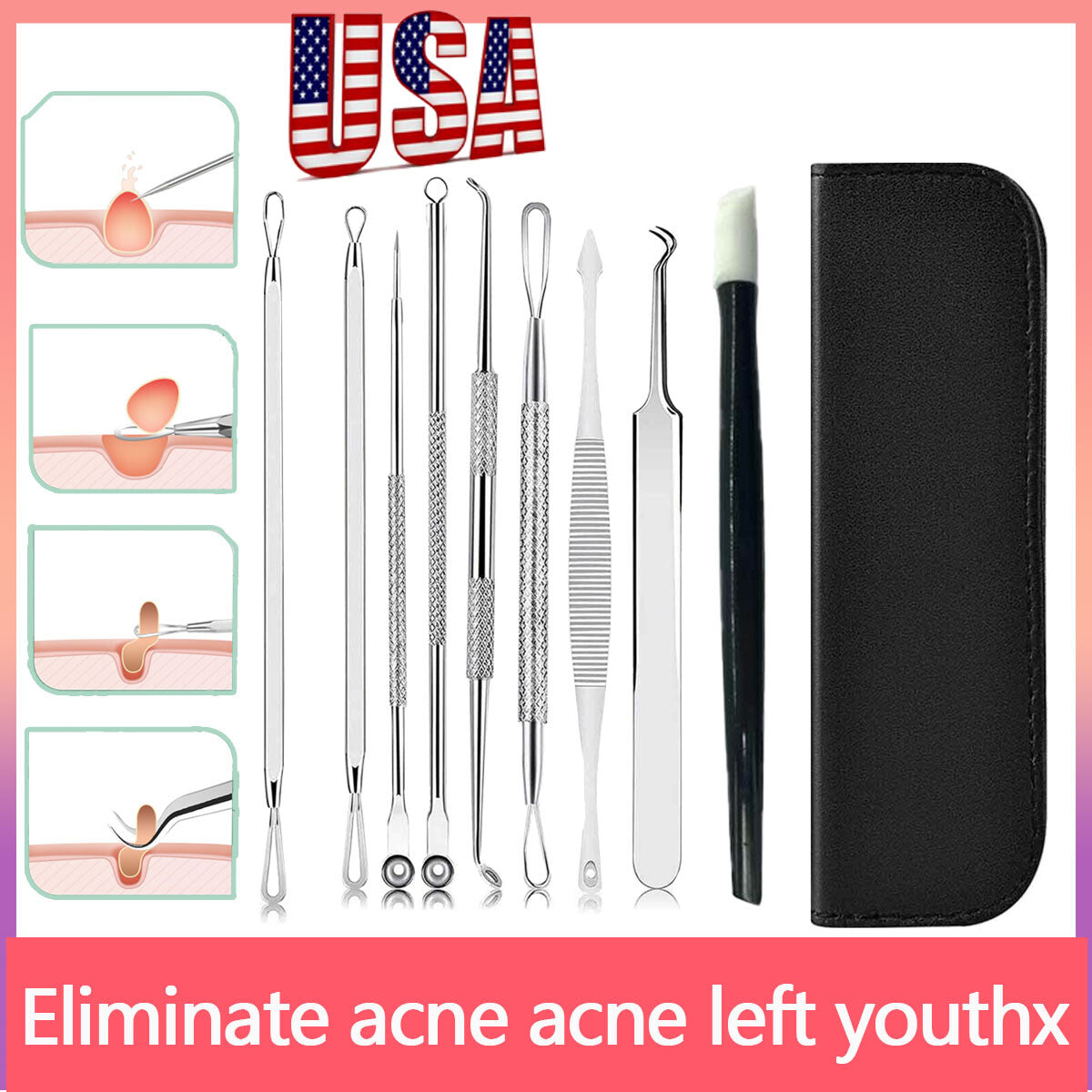 Blackhead Removal Needle Set for Acne Pimple Extraction - Double-Ended Tools