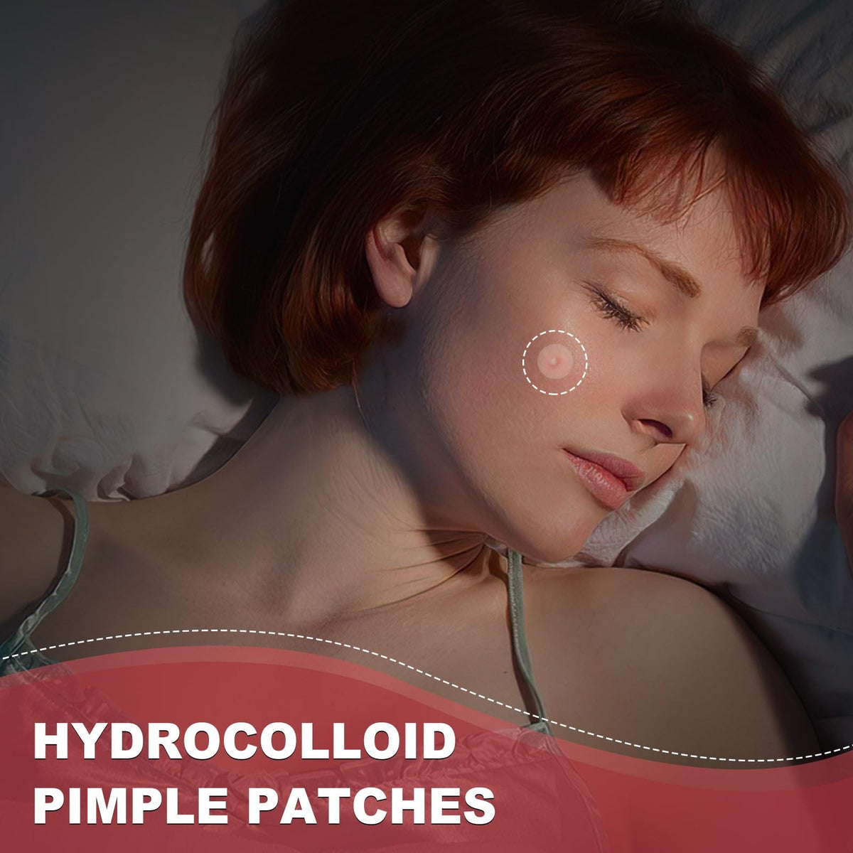 Hydrocolloid Acne Patches for Face, 216 Count