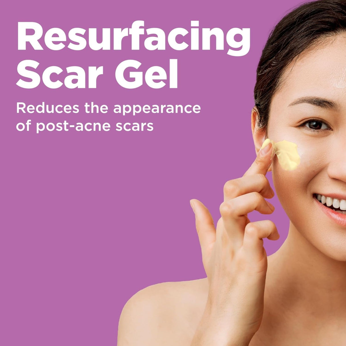 Gentle Acne Scar Treatment Gel for Sensitive Skin - 1 Oz