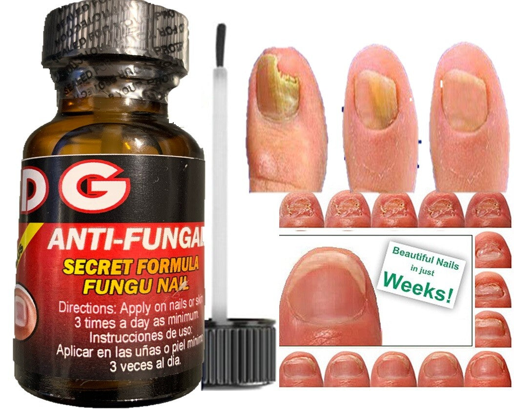 Nail Fungus Support Liquid - Natural Antifungal Nail Treatment 1oz