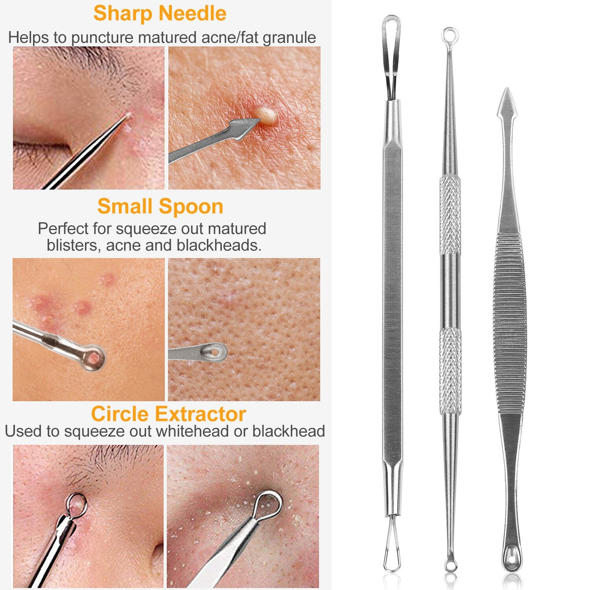 Blackhead Remover Kit 5 Pcs Facial Pimple Extractor Tools Set