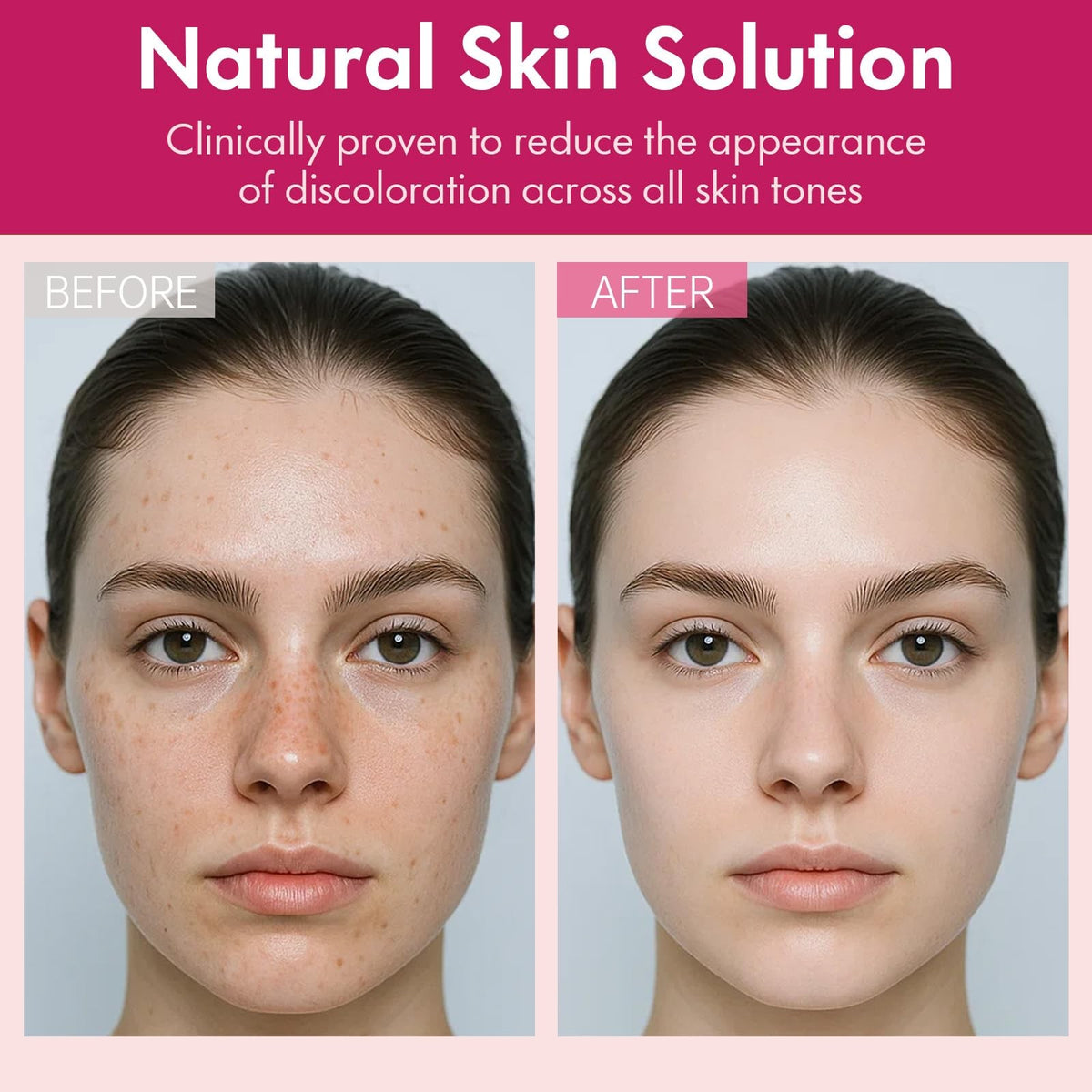 Arbutin 7% and Tranexamic Acid Face Cream for Dark Spots - 1.76 oz
