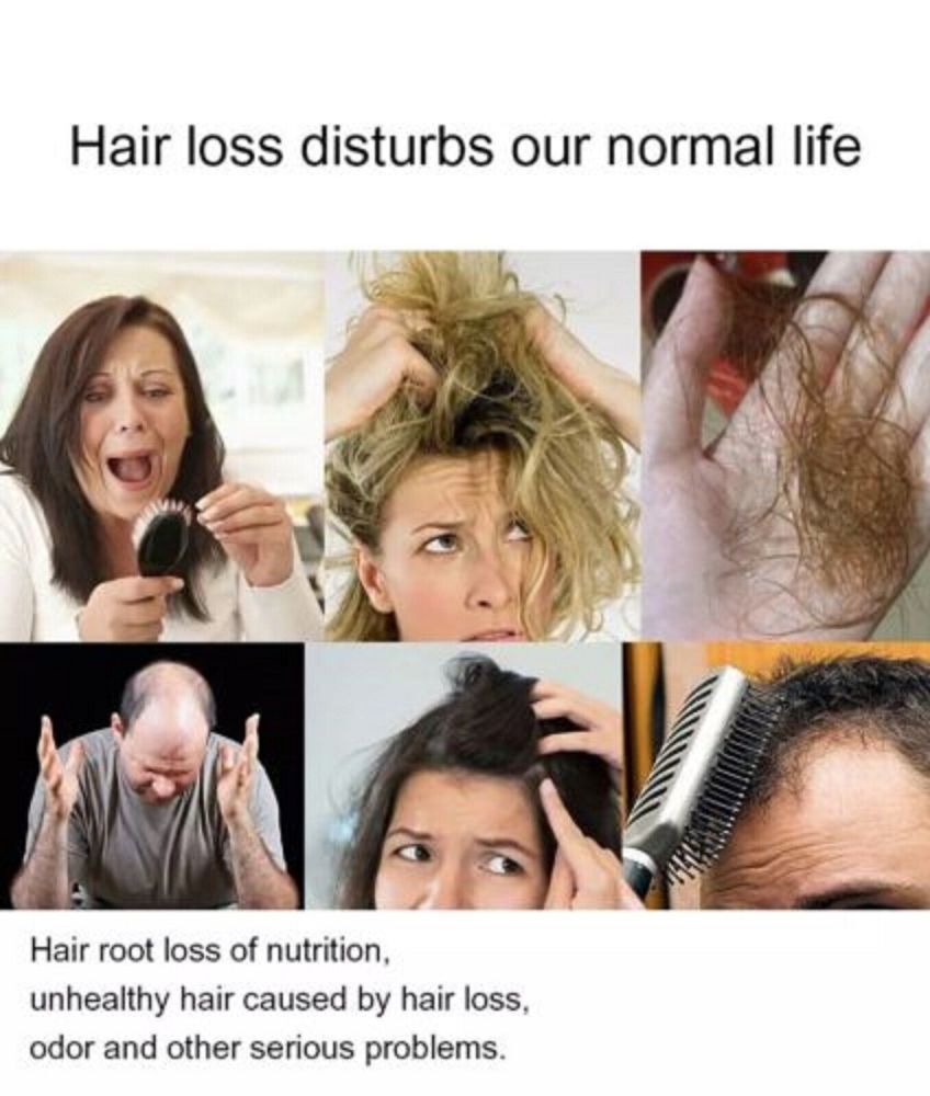 DEXE Anti-Hair Loss Shampoo Chinese Herbal Hair Regrowth Growth For
