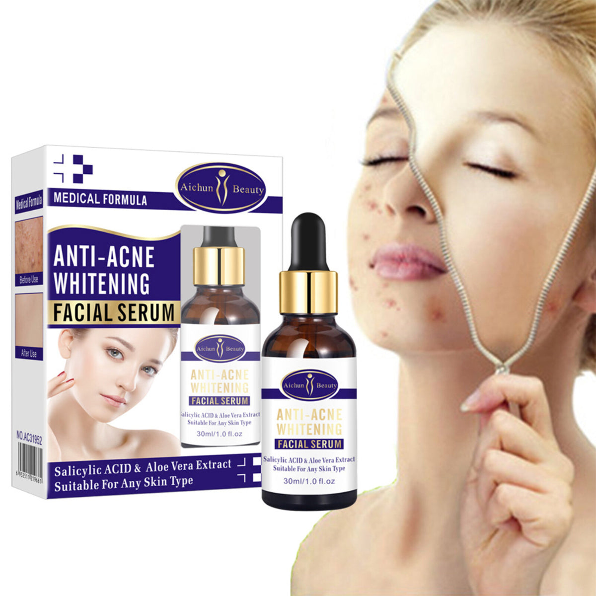 Anti-Acne Face Serum with Aloe Vera & Salicylic Acid for Skin Repair